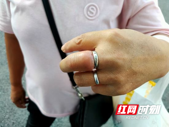 张家界慈利：女子戒指卡手&ldquo;无法自拔&rdquo; 消防员助其解困